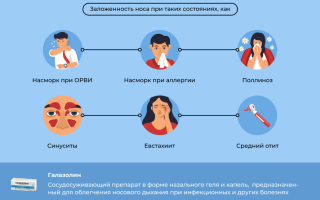 Инструкция по использованию капель для носа Галазолин: полезные советы и рекомендации
