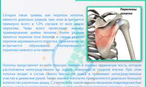 Боль под левой лопаткой сзади со спины: причины и лечение