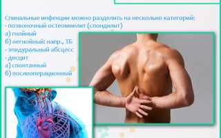 Жжение в спине: причины и лечение