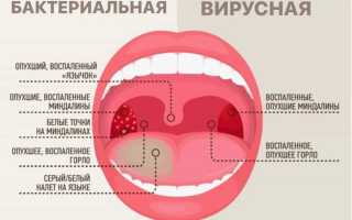 Первая помощь при обнаружении красного горла у грудничка: советы и рекомендации