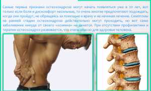 Тахикардия при остеохондрозе: причины и последствия
