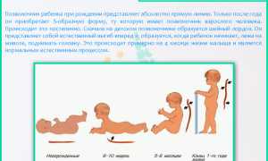 Искривление позвоночника у детей: причины и последствия