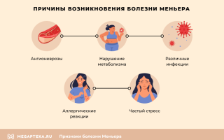 Определение симптомов и выбор лечения при болезни Меньера для эффективного выздоровления
