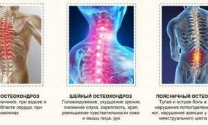 Торакалгия на фоне остеохондроза грудного отдела позвоночника: причины и лечение
