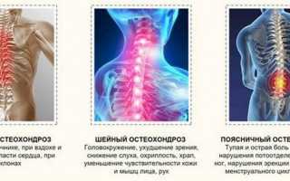Торакалгия на фоне остеохондроза грудного отдела позвоночника: причины и лечение