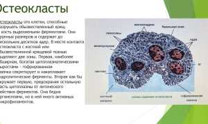 Бисфосфонаты для лечения остеопороза: эффективность и применение