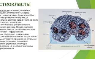 Бисфосфонаты для лечения остеопороза: эффективность и применение