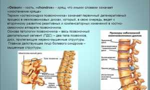ЛФК при остеохондрозе: эффективные методы и рекомендации