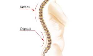 Кифотическая осанка: причины и последствия