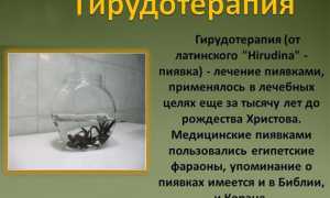 Пиявки при остеохондрозе шейного отдела: польза и применение