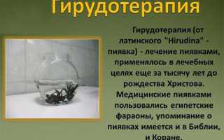 Пиявки при остеохондрозе шейного отдела: польза и применение