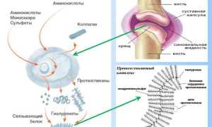 Остеоартроз позвоночника: причины и лечение