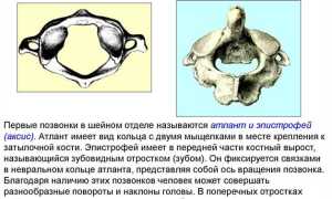 Протрузии дисков с3-c4, c4-с5, с5-c6: причины и лечение