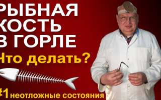 Что делать, если рыбья кость застряла в горле: полезные советы и рекомендации