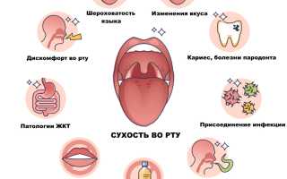 Причины сухости в горле и их последствия