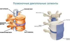 Можно ли греть межпозвоночную грыжу? Ответы и рекомендации