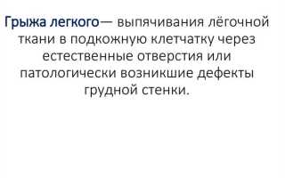 Межреберная грыжа: причины и лечение