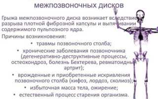 Массаж позвоночника при грыже: польза и рекомендации