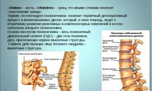 Остеохондроз 1 степени поясничного отдела: причины и лечение