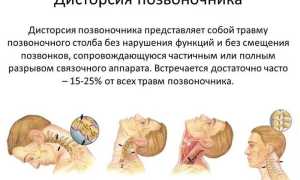 Дисторсия шейного отдела позвоночника: причины и лечение