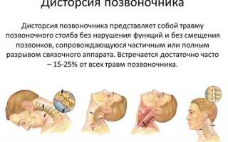 Дисторсия шейного отдела позвоночника: причины и лечение