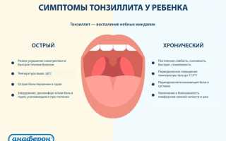Особенности лечения тонзиллита у детей: важные аспекты и рекомендации