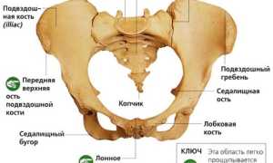Боли в крестцовом отделе позвоночника у женщин: причины и лечение