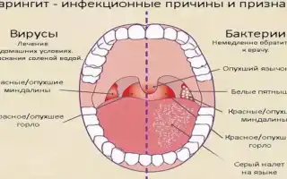 Методы терапии при аллергическом фарингите: эффективные подходы и рекомендации