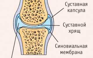 Почему хрустит позвоночник: причины и последствия