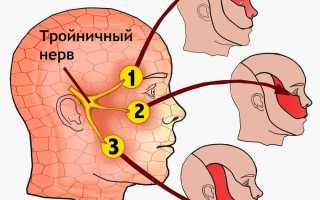 Защемление тройничного нерва: причины и лечение