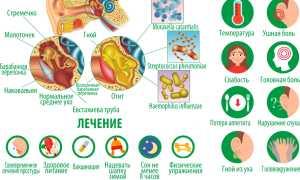 Как протекает отит у детей: симптомы и лечение