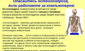 Гимнастика для лечения шейного остеохондроза в домашних условиях: полезные советы и рекомендации