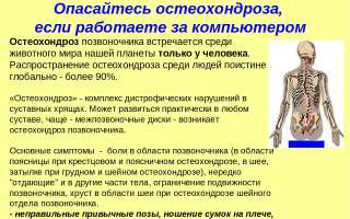 Гимнастика для лечения шейного остеохондроза в домашних условиях: полезные советы и рекомендации