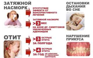 Проблема аденоидов у детей: причины и решения