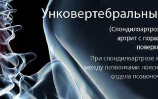 Ункоартроз шейного отдела позвоночника: причины и лечение