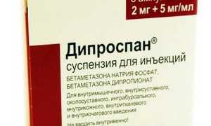 «Дипроспан» уколы: отзывы при остеохондрозе и их эффективность