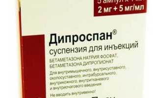 «Дипроспан» уколы: отзывы при остеохондрозе и их эффективность