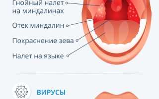Действия, если в горле чешется и першит, для облегчения симптомов