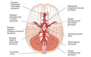 Гипоплазия левой/правой позвоночной артерии — что это такое и как с этим жить?