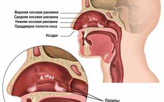 Причины возникновения полипов в горле и способы их лечения: важные аспекты здоровья