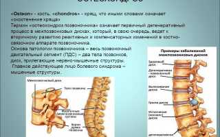 Последствия остеохондроза для здоровья человека