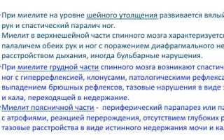 Миелит спинного мозга: причины и симптомы