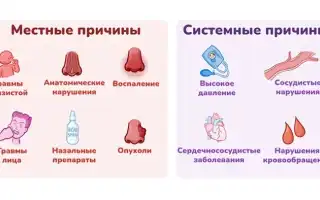 Причины появления крови из носа: основные факторы и рекомендации