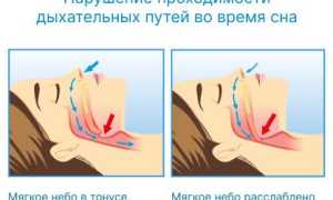 Причины появления храпа у женщин во время беременности и их последствия