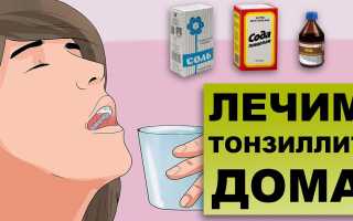 Методы лечения хронического тонзиллита в домашних условиях: советы и рекомендации