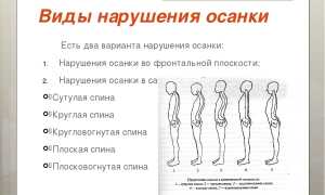 Исправление осанки у взрослых для здоровья и комфорта