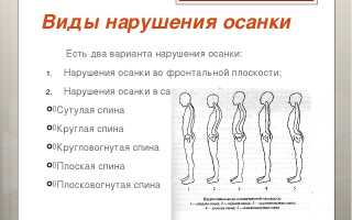 Исправление осанки у взрослых для здоровья и комфорта