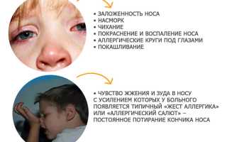 Лечение аллергического насморка у ребенка: советы и рекомендации