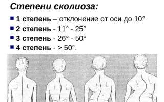 Зарядка для сколиоза: эффективные упражнения и советы