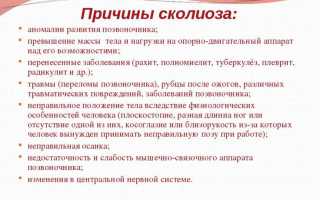 Левосторонний сколиоз: причины и лечение